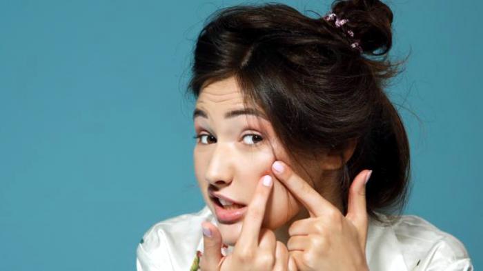 Tak Perlu Khawatir, Ini Alasan Pakai Skincare Baru Justru Timbul Jerawat